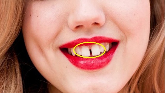đoán số phận qua tướng răng của phụ nữ