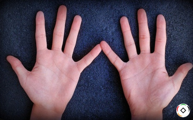 Bói chỉ tay: Nếu có vân tay CHỮ M, bạn là người rất đặc biệt