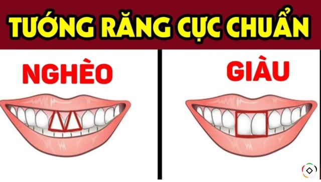 Xem tướng răng cực chuẩn tại Phong thủy Nguyễn Hoàng