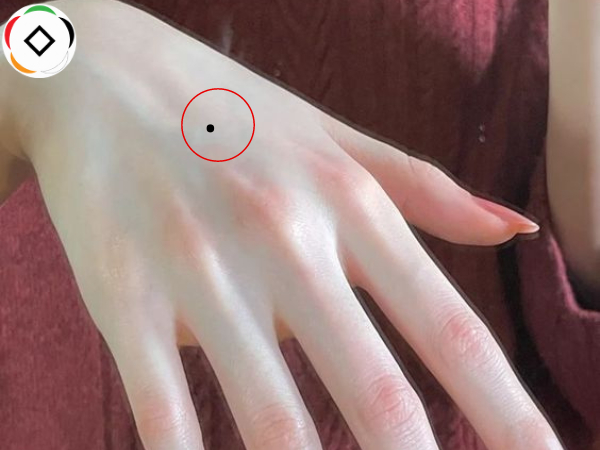 ảnh hưởng của nốt ruồi trên mu bàn tay