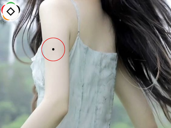 nốt ruồi ở cánh tay trái nữ